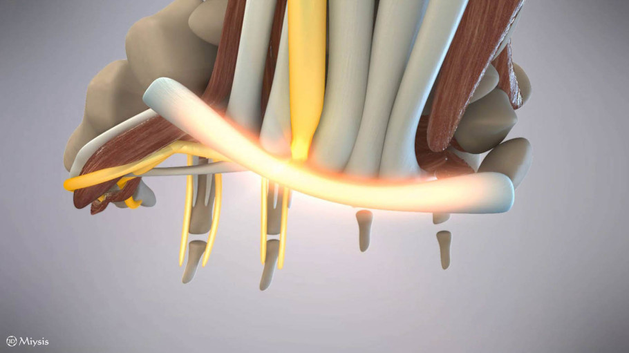 3D Medical